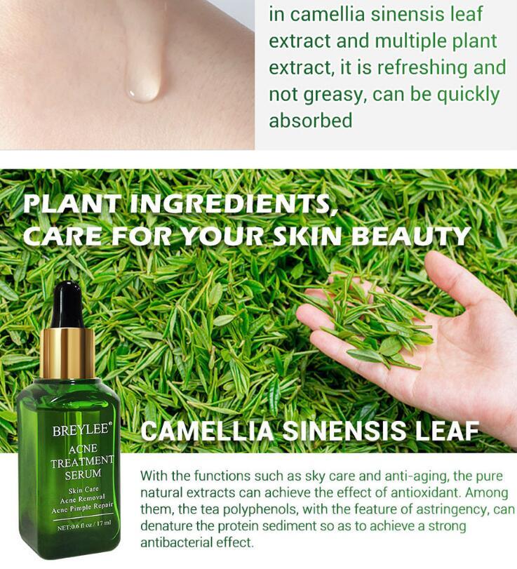 Acne Treatment Serum Facial Repair Oil - Swefashionstore