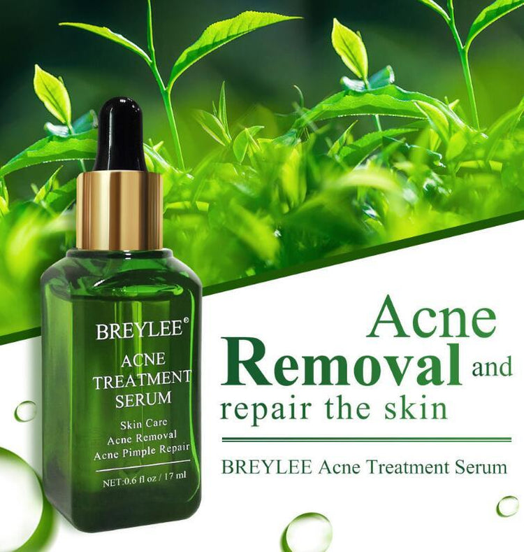 Acne Treatment Serum Facial Repair Oil - Swefashionstore