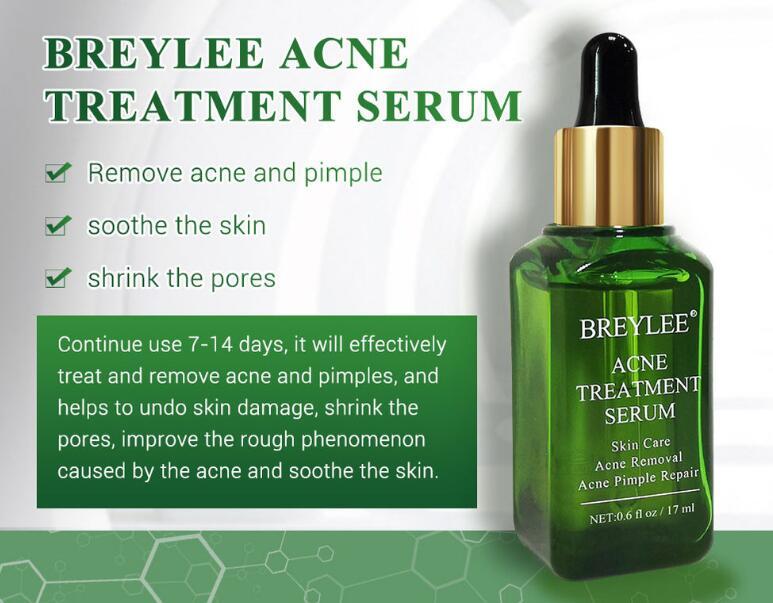 Acne Treatment Serum Facial Repair Oil - Swefashionstore