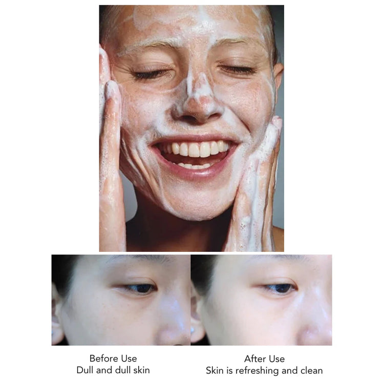 AILKE Rose Facial Cleanser Women Moisturizing Cleaner Hydrating Anti-Dark Spots, Oil Control Face Care Scrub - Swefashionstore