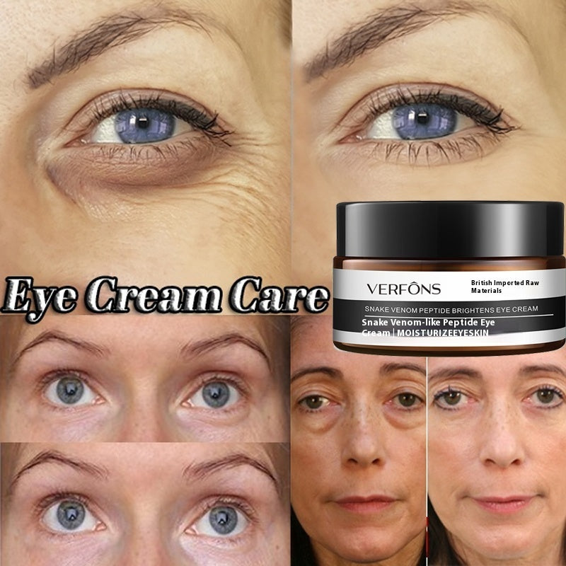 VERFONS Eye Cream Moisturizing Dark Circle Remover
