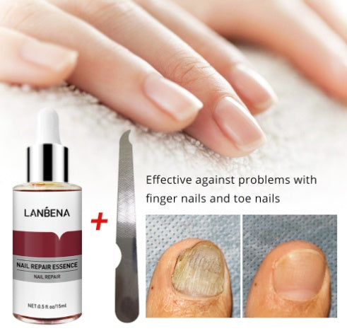 LANBENA Nail Repair And Beauty Care