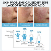 Hyaluronic Acid Face Serum for Anti-Aging and Moisturizing Skin Care - Swefashionstore