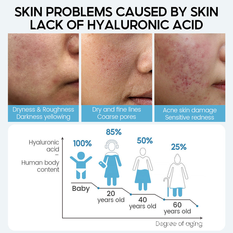 Hyaluronic Acid Face Serum for Anti-Aging and Moisturizing Skin Care - Swefashionstore