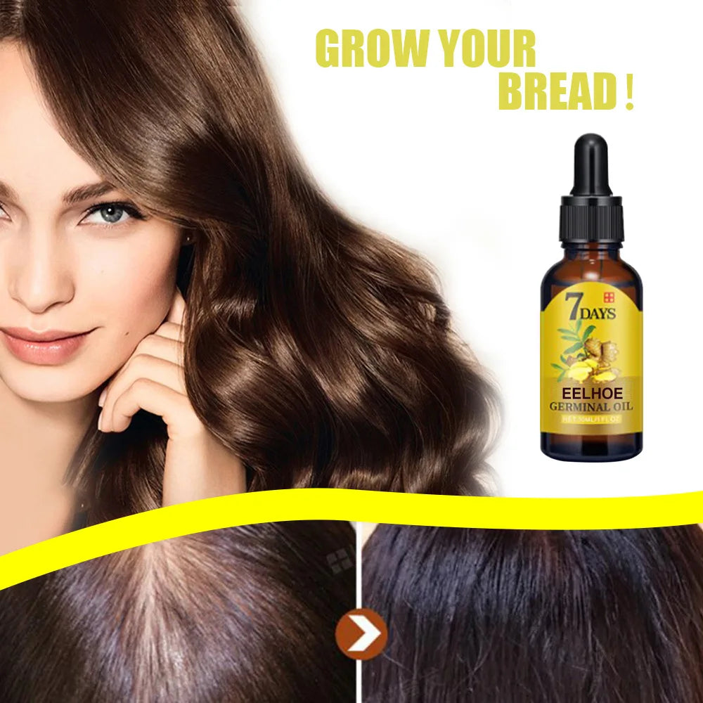 EELHOE Hair GROWTH Oil Natural Essentail ANTI-HAIR Loss Treatment