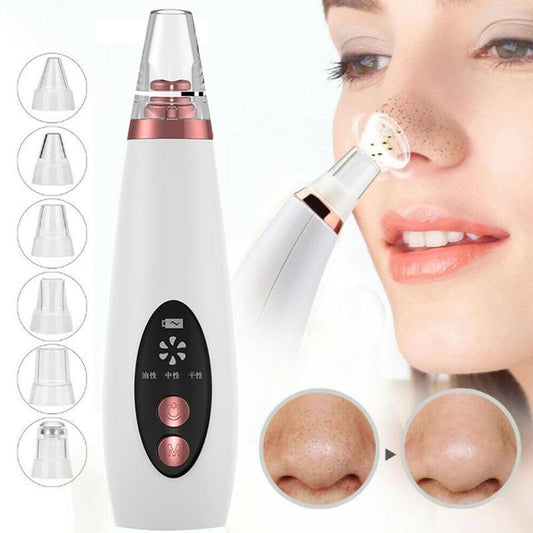 Vacuum Nose and Blackhead Cleaner